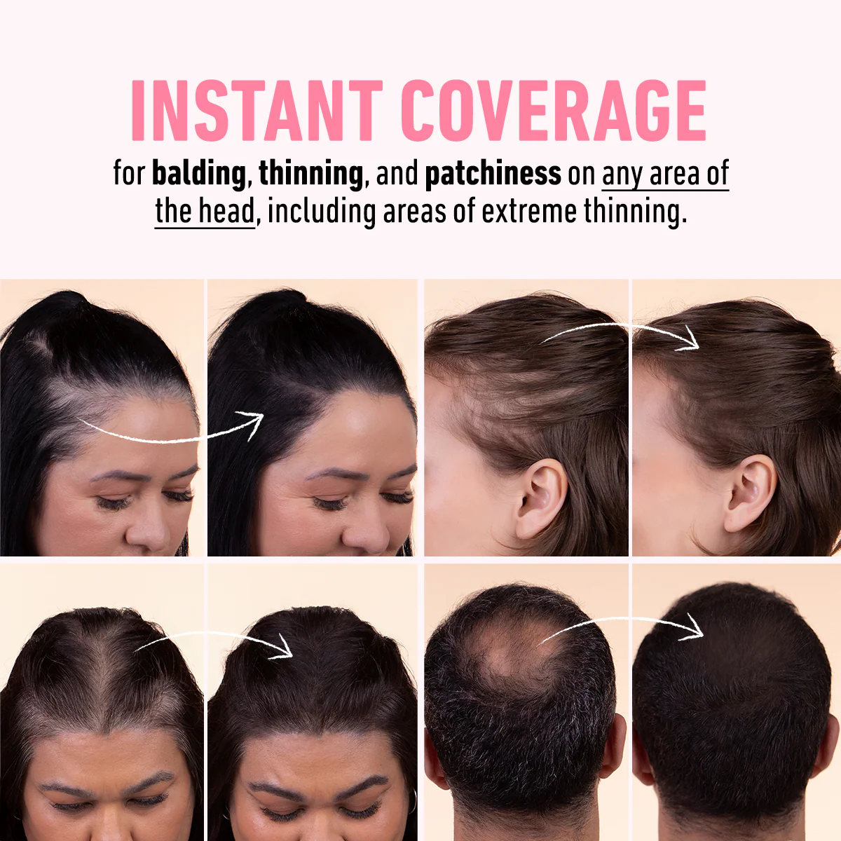THICK FIBER Root Touch Up and Hairline Concealer - Water & Sweat Resistant Hair Loss Powder Set for Thinning Hair, Includes Brush