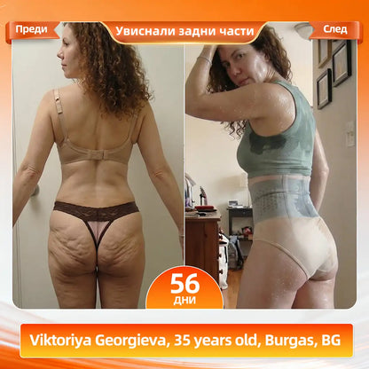 🇧🇬 Официален марков магазин ✔️ | 🏛️AKYGO® 2026 Moringa × Berberine × NAD+ 6-в-1 микро-частици за оформяне на тялото и шорти за изгаряне на мазнини (за жени и мъже с подобрена подкрепа за мъжката жизненост)