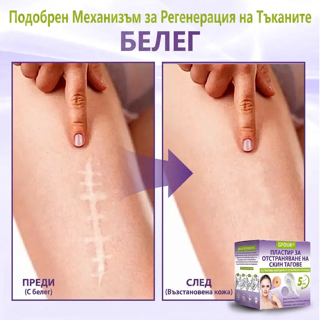 ✨ GFOUK® Разтворим ботанически пластир с микроигли за премахване на кожни образувания 🌴🌴